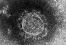 문 대통령 “코로나19 심각단계 격상…대응체계 대폭강화”